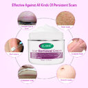 Skin Rebound Scarless Cream Scar Removal Face