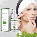 Fade Acne Marks And Tea Tree Skin Care