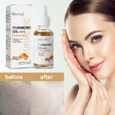 Eelhoe Turmeric Dark Spot Correction Face Care Moisturizing