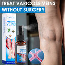 30ml Varicose Vein Spray Multi-Purpose Knee And Leg