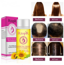 Fast Powerful Hair Growth Products Essential Oil Liquid
