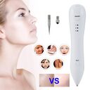 Spot Removal Pen Face Skin Dark Remover