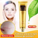 Acne Scar Removal Cream Skin Repair